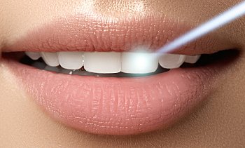 DENTAL SMILE, Αγία Παρασκευή